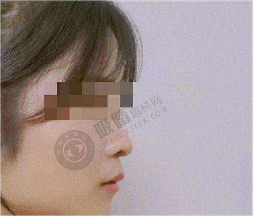 长沙辰姿医疗美容诊所正规靠谱吗?——精良设备助力美容治疗