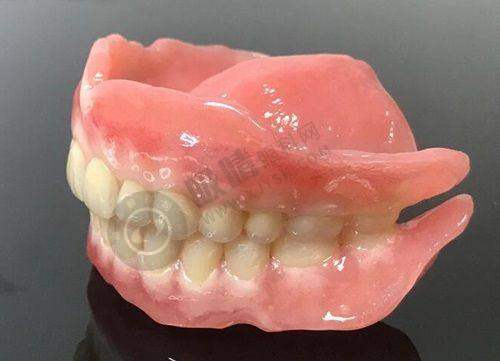 广州柏德口腔门诊部(越秀院区)怎么样?——德系诊疗体系靠不靠谱