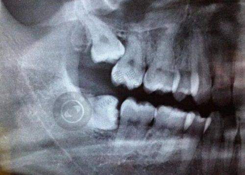 衢州贝加尔口腔诊所可靠吗?透明的价格与优惠活动