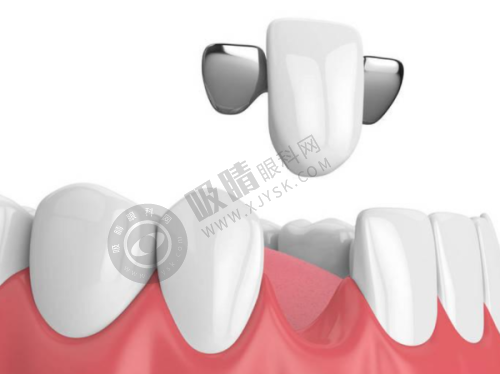 衢州贝加尔口腔诊所可靠吗?隐形矫正联合修复优势
