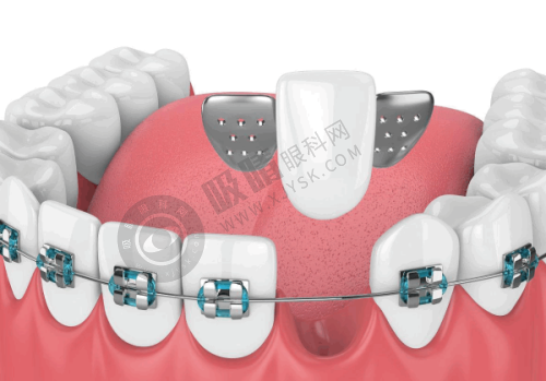 衢州贝加尔口腔诊所的地址在哪里?世纪大道576号环境舒适,种植牙/隐形矫正技术获好评