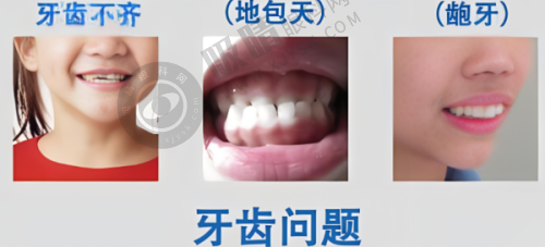 广州三仁口腔门诊部怎么样？数字化种植牙3880元起，刘冠医生万例种植经验保障