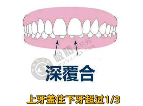 衢州贝加尔口腔诊所收费贵不贵?种植牙技术优势明显