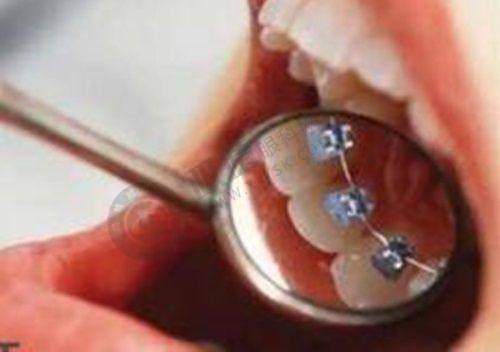 广州三仁口腔门诊部怎么样?技术是否精良?