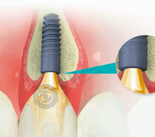 苏州康洁口腔门诊部怎么样?——精良的诊疗设备