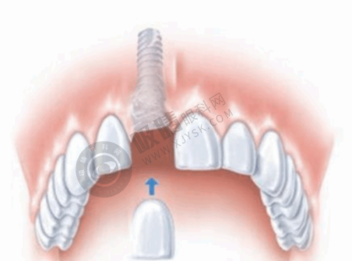 广州三仁口腔医院怎么样?——医生实力雄厚