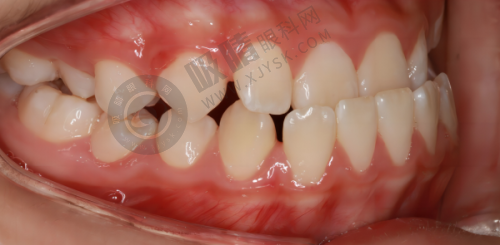 衢州贝加尔口腔诊所收费贵不贵?与其他口腔机构对比见分晓