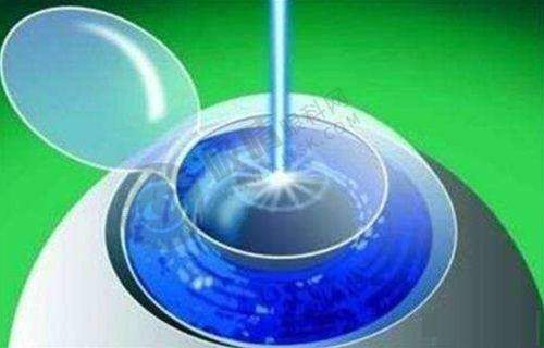 三、中山大学附属第五医院眼科的技术和设备有哪些优势?