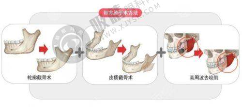 长沙华美诺德医学美容医院怎么样？正规资质+高端设备，美容外科/皮肤科项目口碑佳