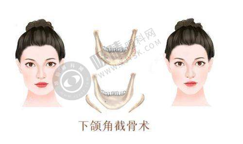 长沙伊百丽梅溪医疗美容门诊部怎么样?行业趋势与优惠活动