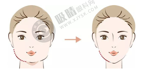 长沙雅瑷医疗美容门诊部怎么样？医生联盟合创机构，玻尿酸丰下巴/除皱项目口碑与技术双优