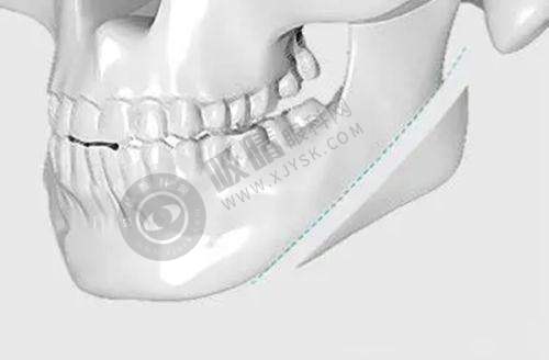 长沙三和整形医院正规靠谱吗?——未来发展展望