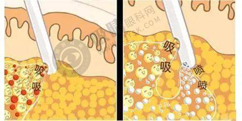 长沙春语医疗美容门诊部怎么样?与其他医美机构对比优势