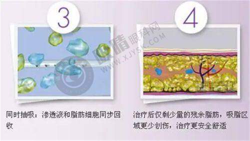 长沙芙蓉区泛美医疗整形美容门诊部怎么样?中日韩技术合作,激光美容祛斑效果显著口碑好