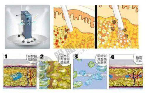 长沙辰姿医疗美容诊所怎么样？顾客口碑见真章