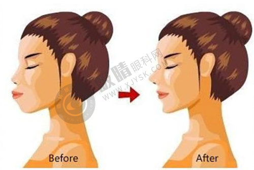 长沙尚美医疗美容门诊部怎么样？——面部年轻化项目解析