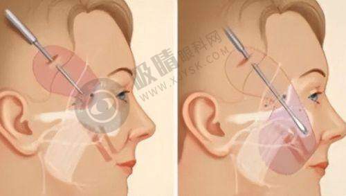 长沙珂妍医疗美容门诊部怎么样？丰胸/美体吸脂塑形技术好，一站式服务口碑佳