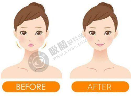 长沙星荟丽格医疗美容门诊部怎么样?——门诊部的其他医美项目