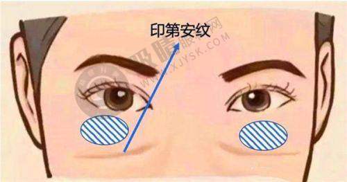 长沙叶甄美整形医院怎么样?热门鼻整形项目一览
