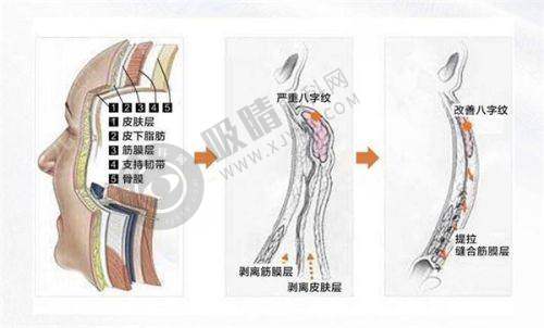 长沙光泽医疗美容门诊部正规靠谱吗?——强大的医生团队支撑