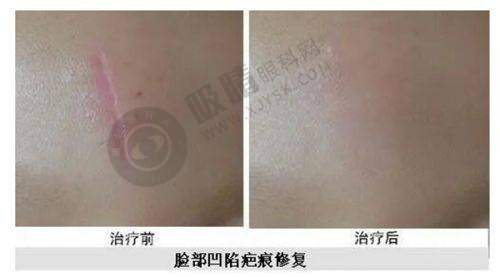 长春于荷琴整形美容诊所正规靠谱吗?——热门项目排名情况