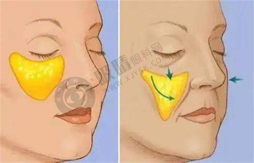 长沙三和整形医院正规靠谱吗?——与其他医院对比优势