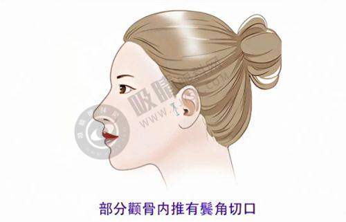 探秘北京韩勋医生眼部修复之真实经历
