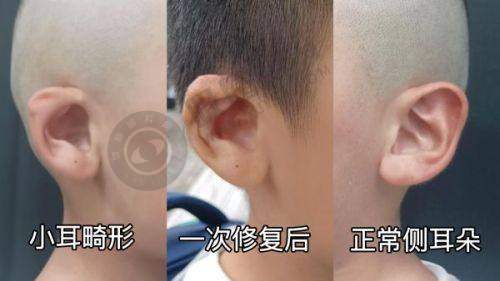 颌面轮廓整形价格
