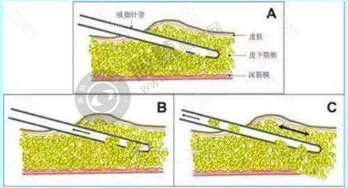 长沙星荟丽格医疗美容门诊部正规靠谱吗?——热门医美项目解读