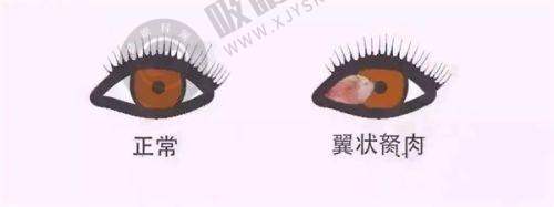 柳州市妇幼保健院眼科怎么样？国家级儿童眼病诊疗中心，斜视弱视筛查技术领先
