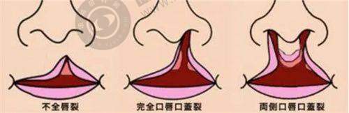 厦门整形医院哪家强？前十榜单揭晓，美莱、福华、海峡谁更胜一筹？