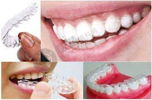 昆明太皓口腔门诊部牙齿矫正有哪些优势?