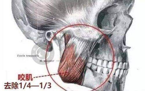 广州可玉医疗美容门诊部怎么样啊？——丰富的医美项目