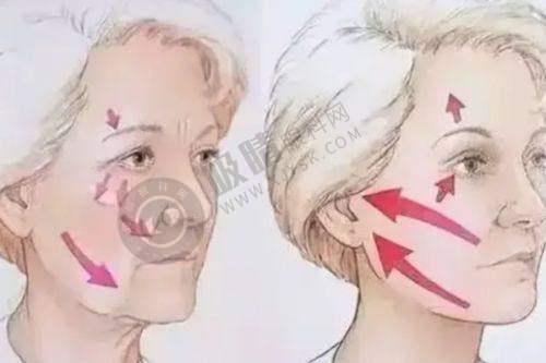 郑州王剑做去眼袋手术怎么样?——患者真实反馈