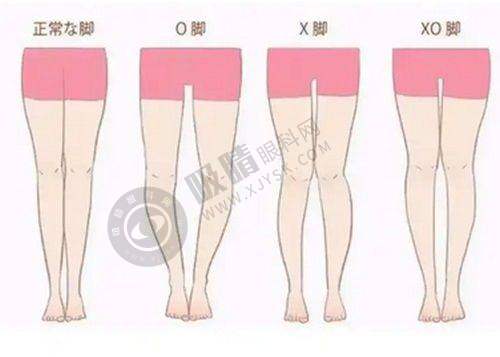 隆鼻失败后怎么办?3大修复方案+真实病例解:杨万忠团队弹性软骨固定技术重塑自然鼻尖