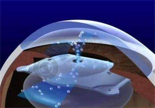 三、济南麦迪格眼科医院有哪些特色眼科项目？