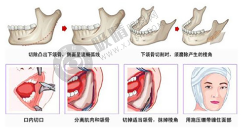北京画美医疗美容医院需要预约吗?正规私立整形机构,马群医生唇部整形口碑好