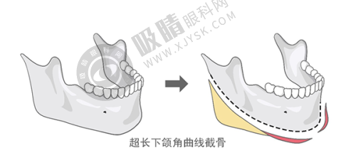 合肥哪家医院祛疤效果好？前十排名揭晓，增生疤痕修复6800元起