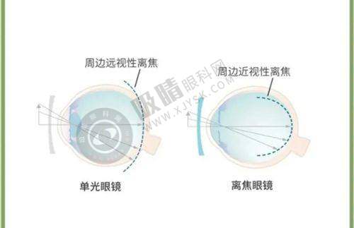 四、深北爱尔眼科医院口碑怎么样?