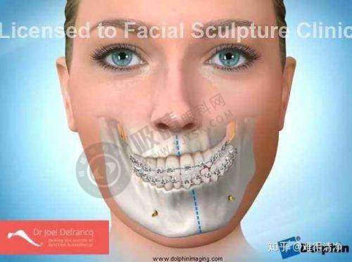 上海华美医疗美容医院结语