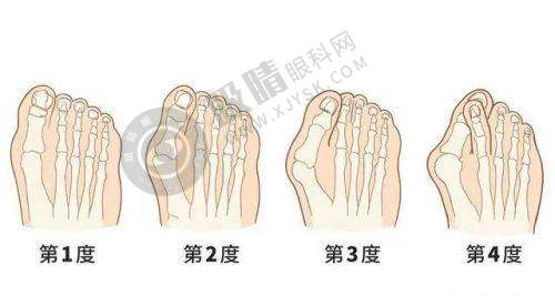 南京美贝尔整形医院价格贵吗？2023最新价目表曝光，隆胸隆鼻超划算！