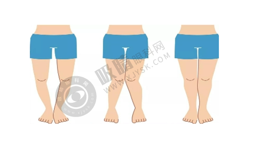 广州海峡取奥美定的医院地址及预约方式