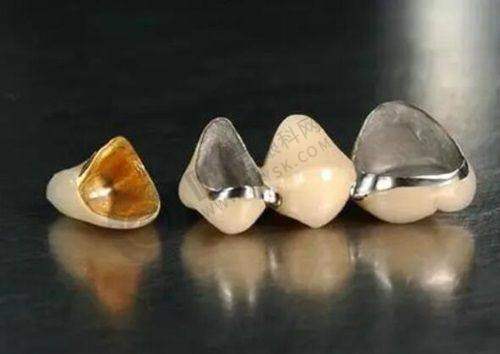 厦门麦芽口腔医院特色项目