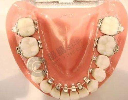 平湖种牙哪家强?麦芽/德康/爱尚等十大靠谱诊所大揭秘!