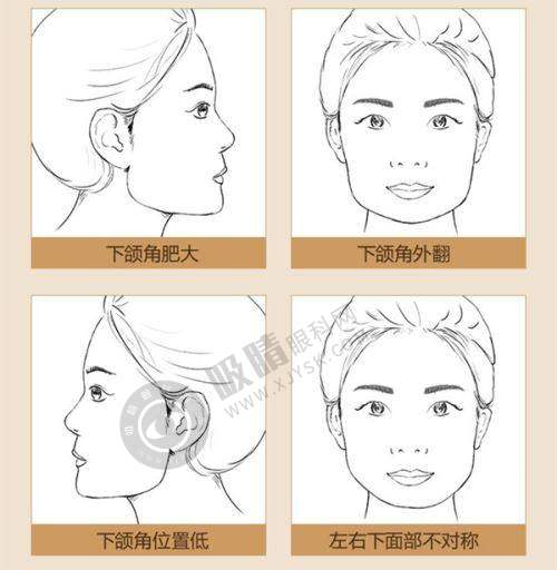 上海九院做双眼皮前四 医生详细介绍