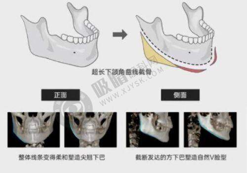 大连爱德丽格整形电话是多少?专业眼修复+异物取出热线公布