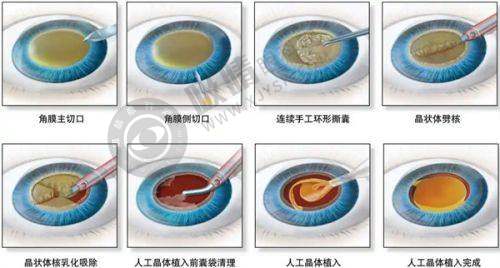厦门美莱医疗美容医院交通及周边