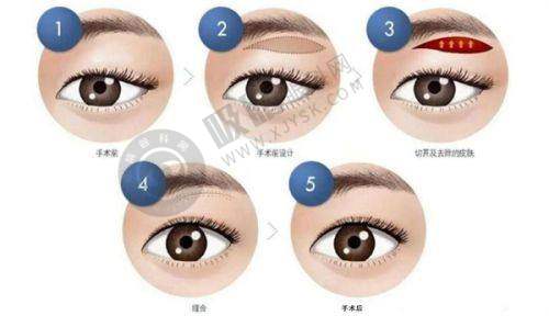 上海华美整形靠谱吗？揭秘35位专家坐镇的医美黑科技！