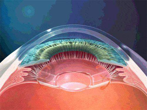 艾维眼科怎么样?(口碑 + 实力解析)