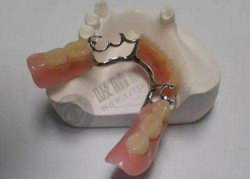 西安诺贝尔口腔种植牙：强大医生团队为你护航